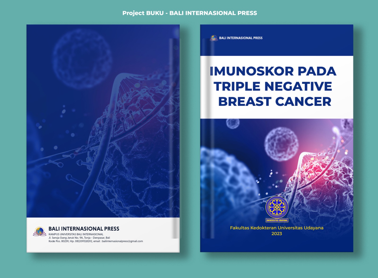 Buku ini mengupas Triple negative breast cancer (TNBC) yang merupakan subtipe kanker payudara yang secara klinis, lebih agresif dengan prognosis lebih buruk dibanding subtipe lainnya. Profil imunitas pada lingkungan mikro kanker dapat digunakan untuk memp